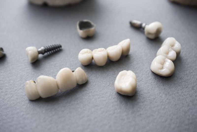 loose dental crowns and bridge models.